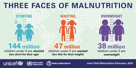 India S Malnutrition Problem Achievers Ias Classes